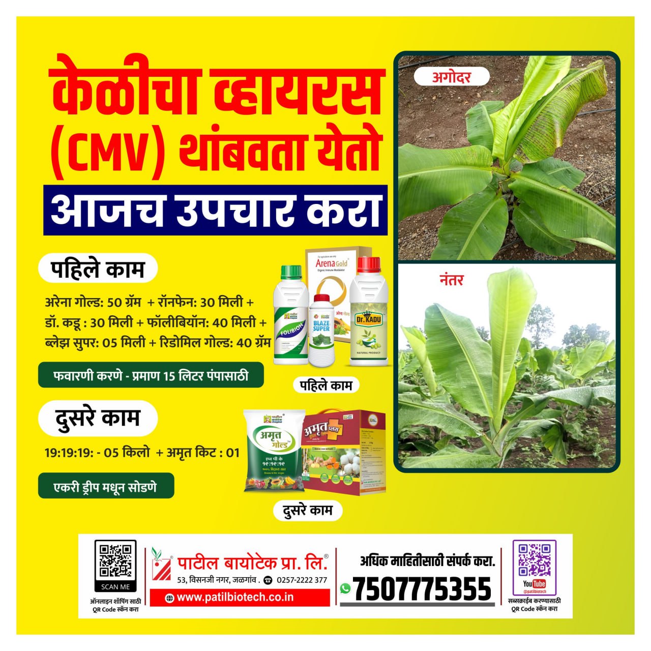 सीएमवी किट